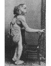 Фотография Джозеф Меррик Jozef Merrik